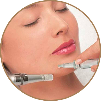Microneedling con Dermapen